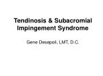 PPT - Impingement Syndrome PowerPoint Presentation, Free Download - ID ...