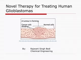 Novel Therapy for Treating Human Glioblastomas