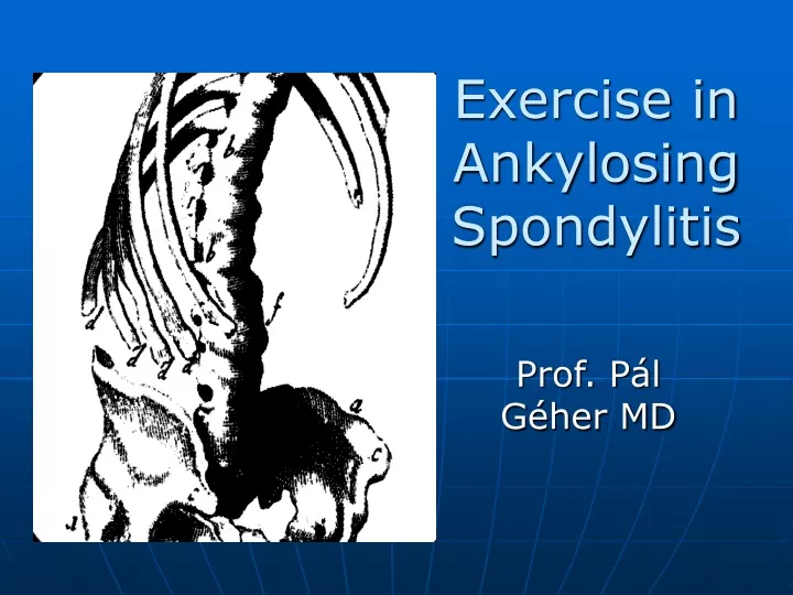 exercise in ankylosing spondylitis