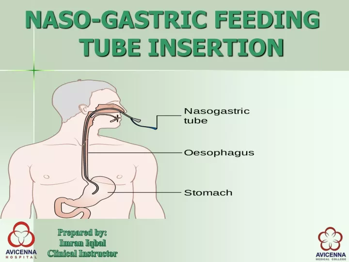 naso gastric feeding tube insertion