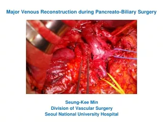 Major Venous Reconstruction during Pancreato-Biliary Surgery