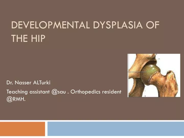 developmental dysplasia of the hip