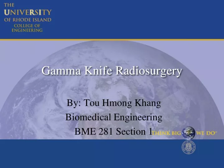 gamma knife radiosurgery