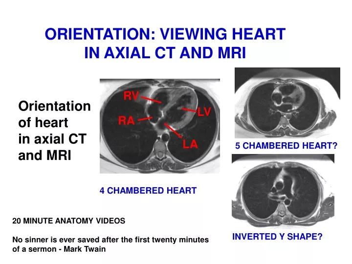 orientation viewing heart in axial ct and mri