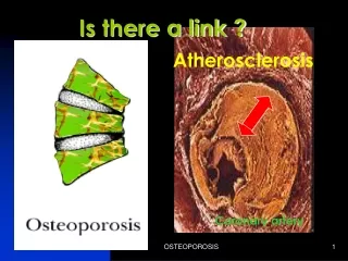 Atherosclerosis