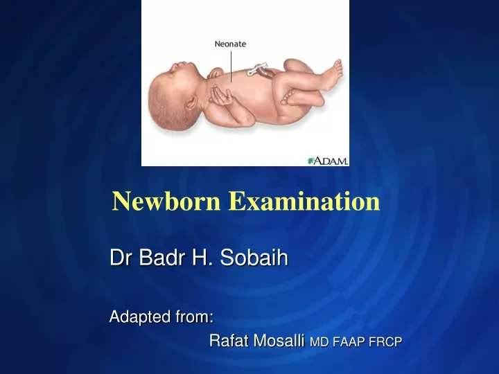 newborn examination