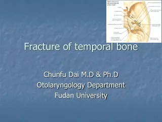 Fracture of temporal bone