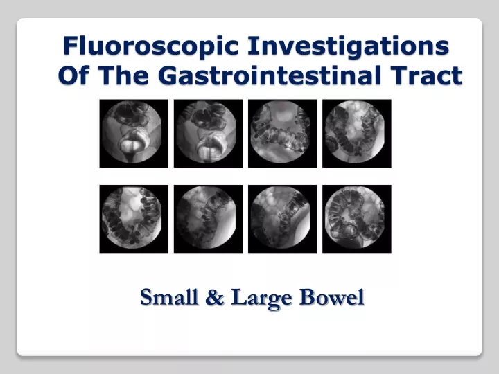 fluoroscopic investigations