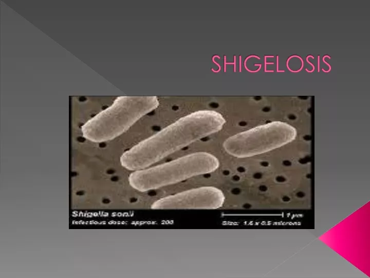 shigelosis