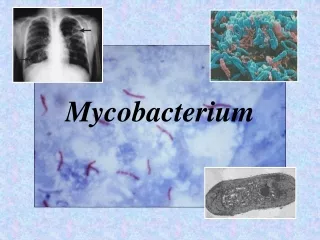 Mycobacterium