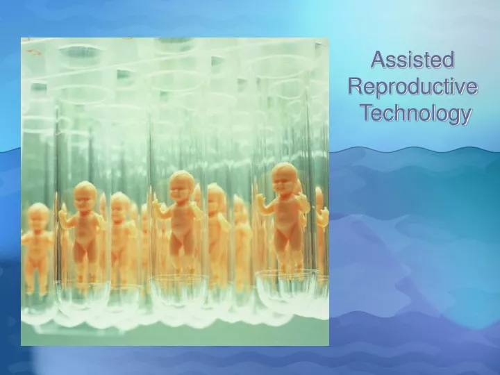 assisted reproductive technology