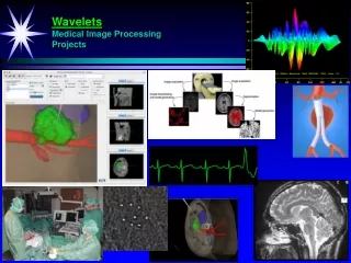 Wavelets Medical Image Processing Projects