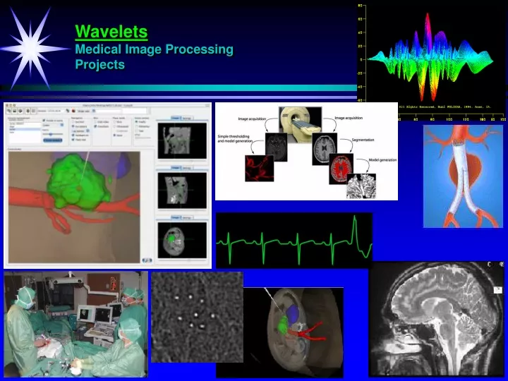 wavelets medical image processing projects