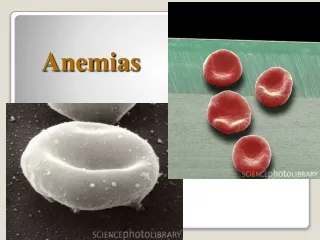 Anemias