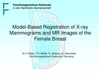 Model-Based Registration of X-ray Mammograms and MR Images of the Female Breast