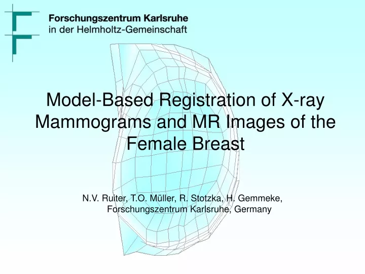 model based registration of x ray mammograms and mr images of the female breast