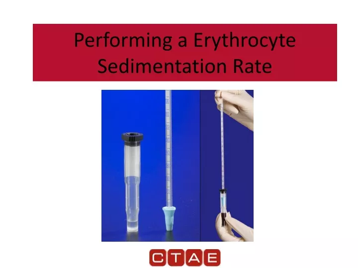 performing a erythrocyte sedimentation rate