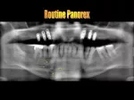 Comprehensive Dental Imaging Review for Patient Care - slide 1