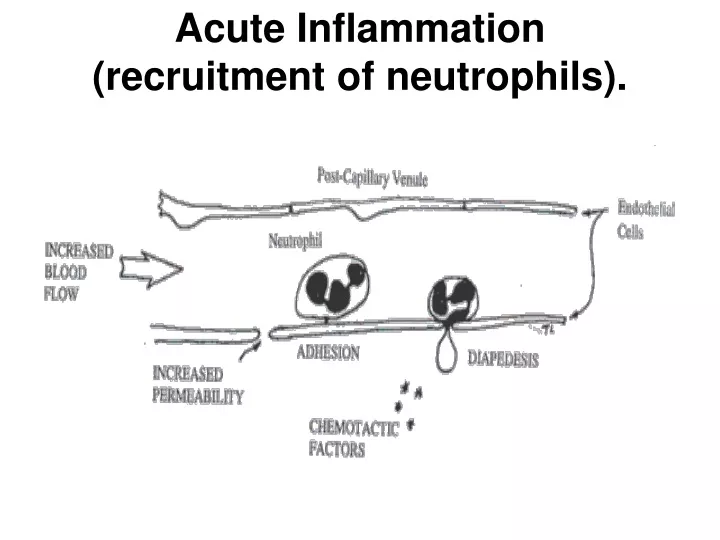 acute inflammation recruitment of neutrophils