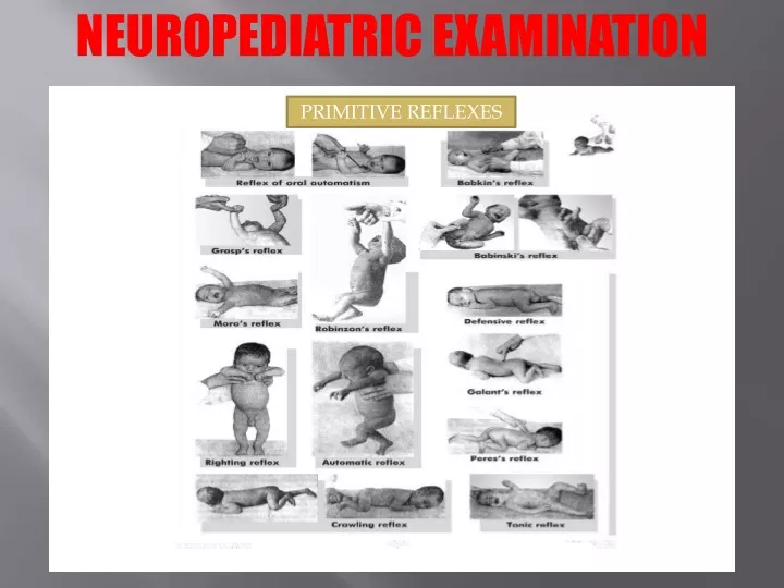 neuropediatric examination