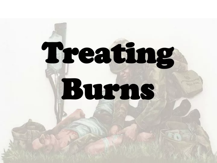 treating burns