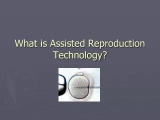 What is Assisted Reproduction Technology?