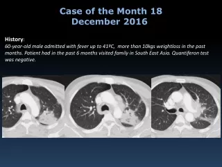 Case of the Month 18 December 2016