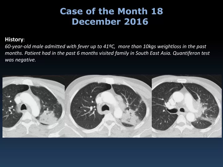 case of the month 18 december 2016
