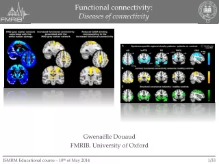Functional connectivity: Diseases of connectivity