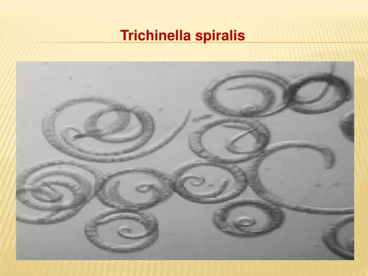 trichinella spiralis