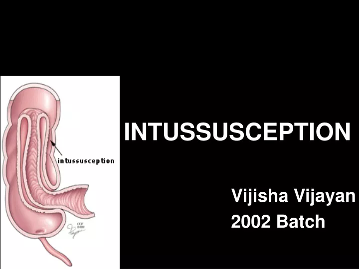 intussusception vijisha vijayan 2002 batch