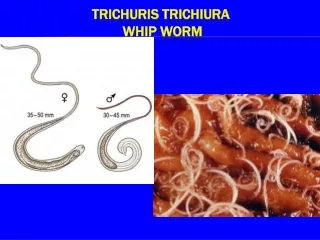 Trichuris trichiura  Whip worm