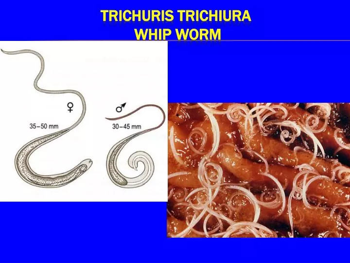 trichuris trichiura whip worm