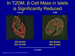 In T2DM, β-Cell Mass in Islets is Significantly Reduced