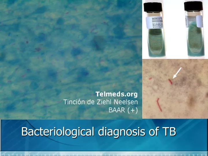 bacteriological diagnosis of tb