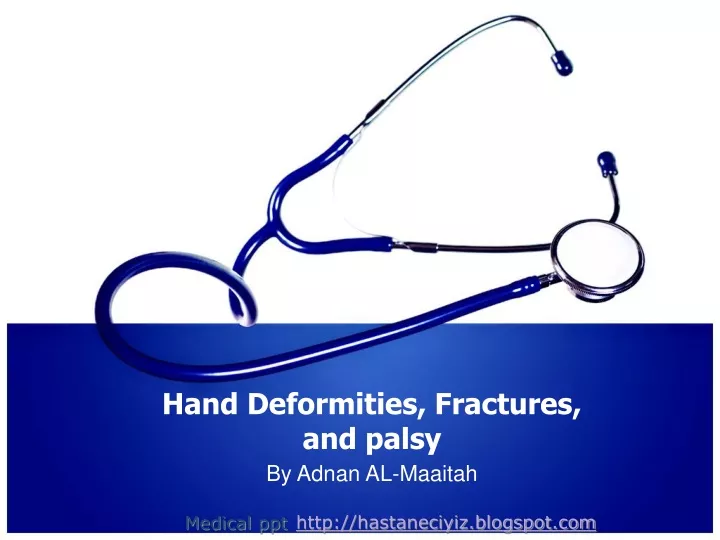 hand deformities fractures and palsy