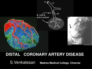 DISTAL   CORONARY ARTERY DISEASE S.Venkatesan  Madras Medical College. Chennai