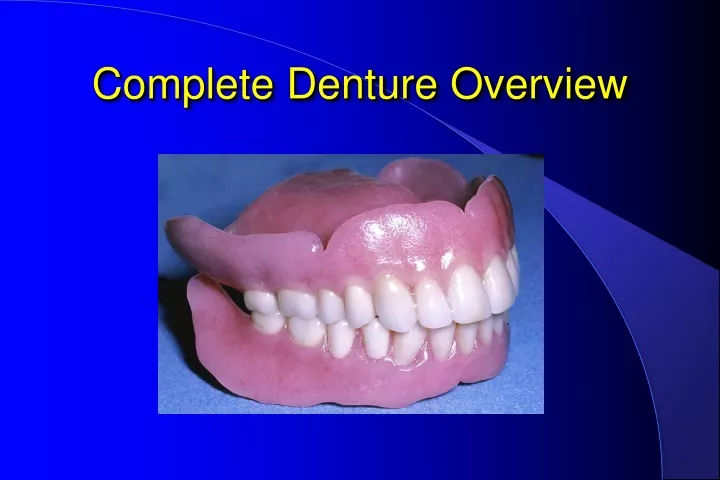 complete denture overview