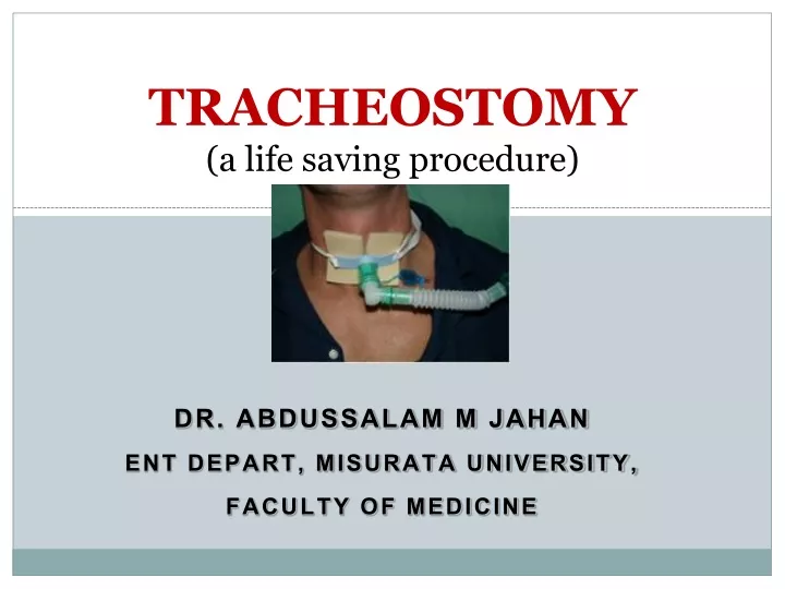 tracheostomy a life saving procedure
