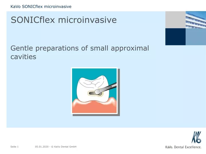 sonicflex microinvasive