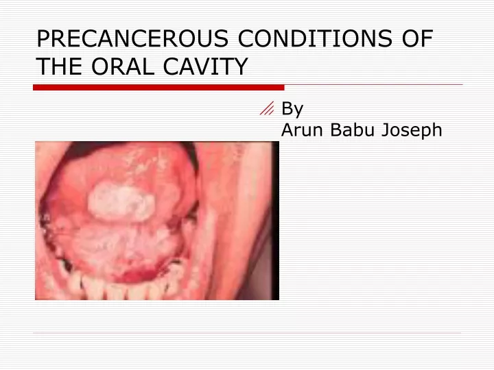 precancerous conditions of the oral cavity