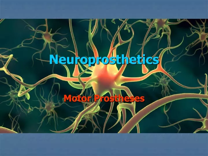 neuroprosthetics