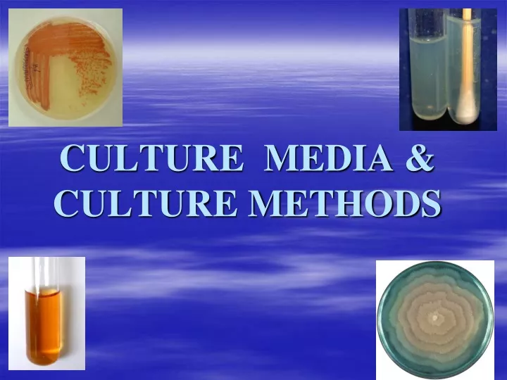 culture media culture methods