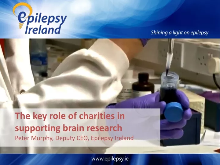the key role of charities in supporting brain research peter murphy deputy ceo epilepsy ireland