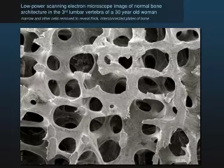 Low-power scanning electron microscope image of normal bone
