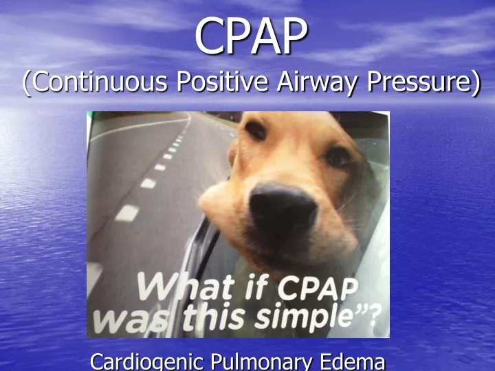 cpap continuous positive airway pressure