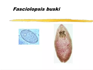 Fasciolopsis buski
