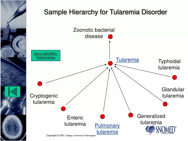 sample hierarchy for tularemia disorder