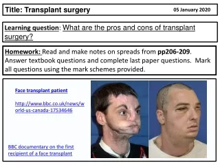 Learning question :  What are the pros and cons of transplant surgery ?
