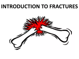 INTRODUCTION TO FRACTURES